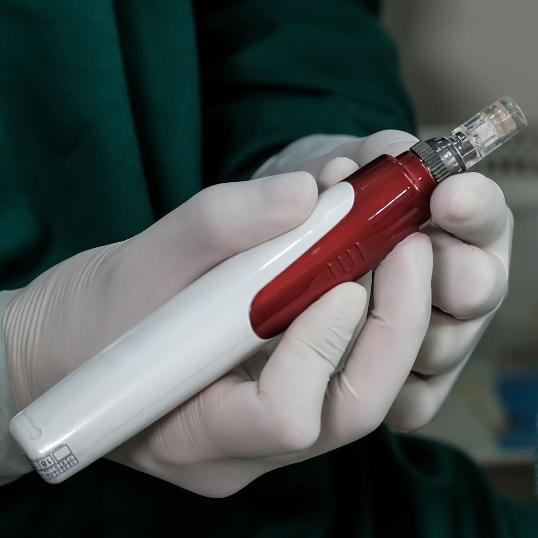 Injection de PRP