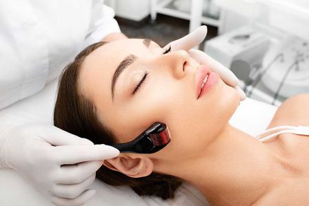 Microneedling