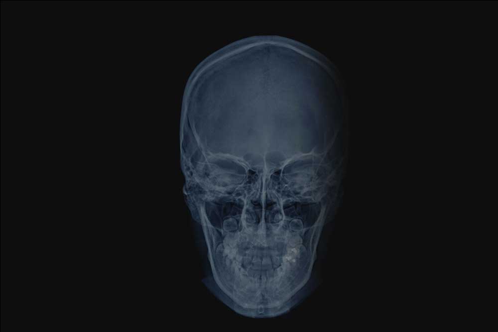 Cephalometry