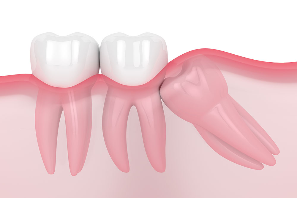 Dentisterie - Stomatologie